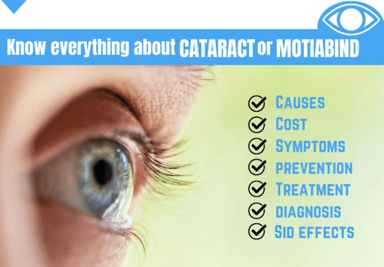 Know everything about Cataract or Motiabind surgery