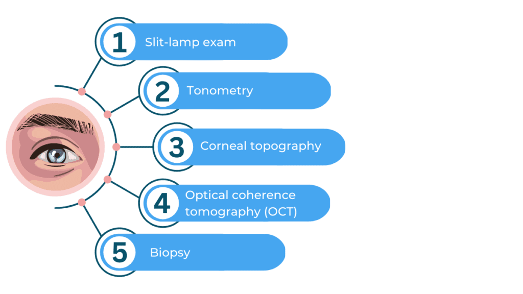 How to diagnose corneal diseases? ​