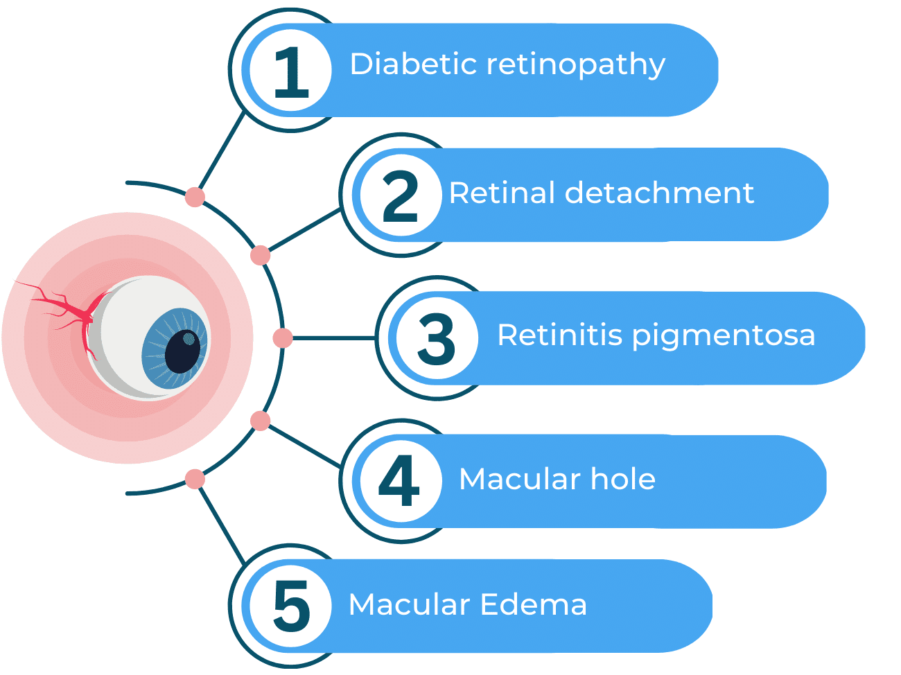 Know everything about Retina Diseases and Vitro-Retinal treatments!