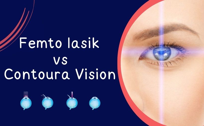 Femto lasik vs Contoura Vision