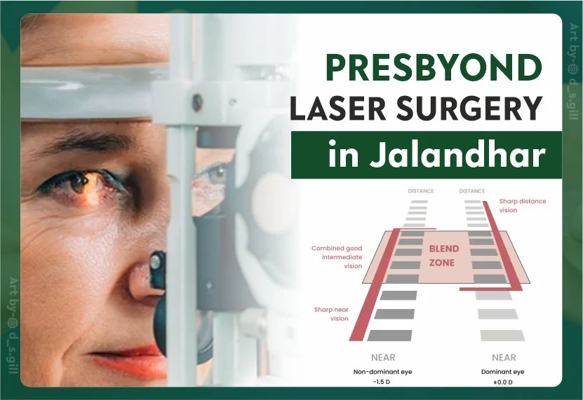 Presbyond Laser Vision Correction