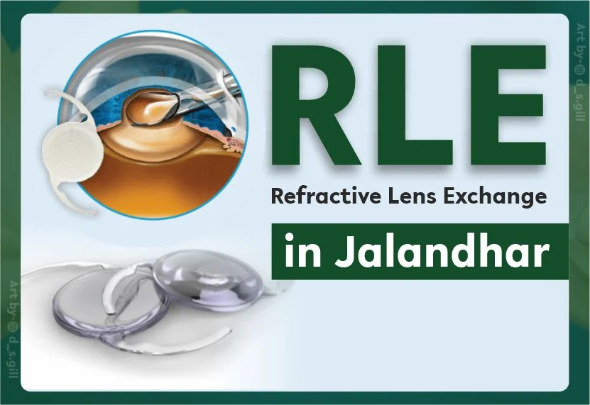 RLE Eye Surgery at Duggal Eye Hospital
