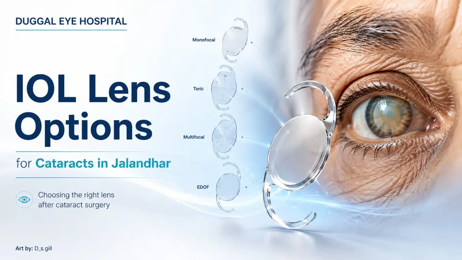 IOL Lens