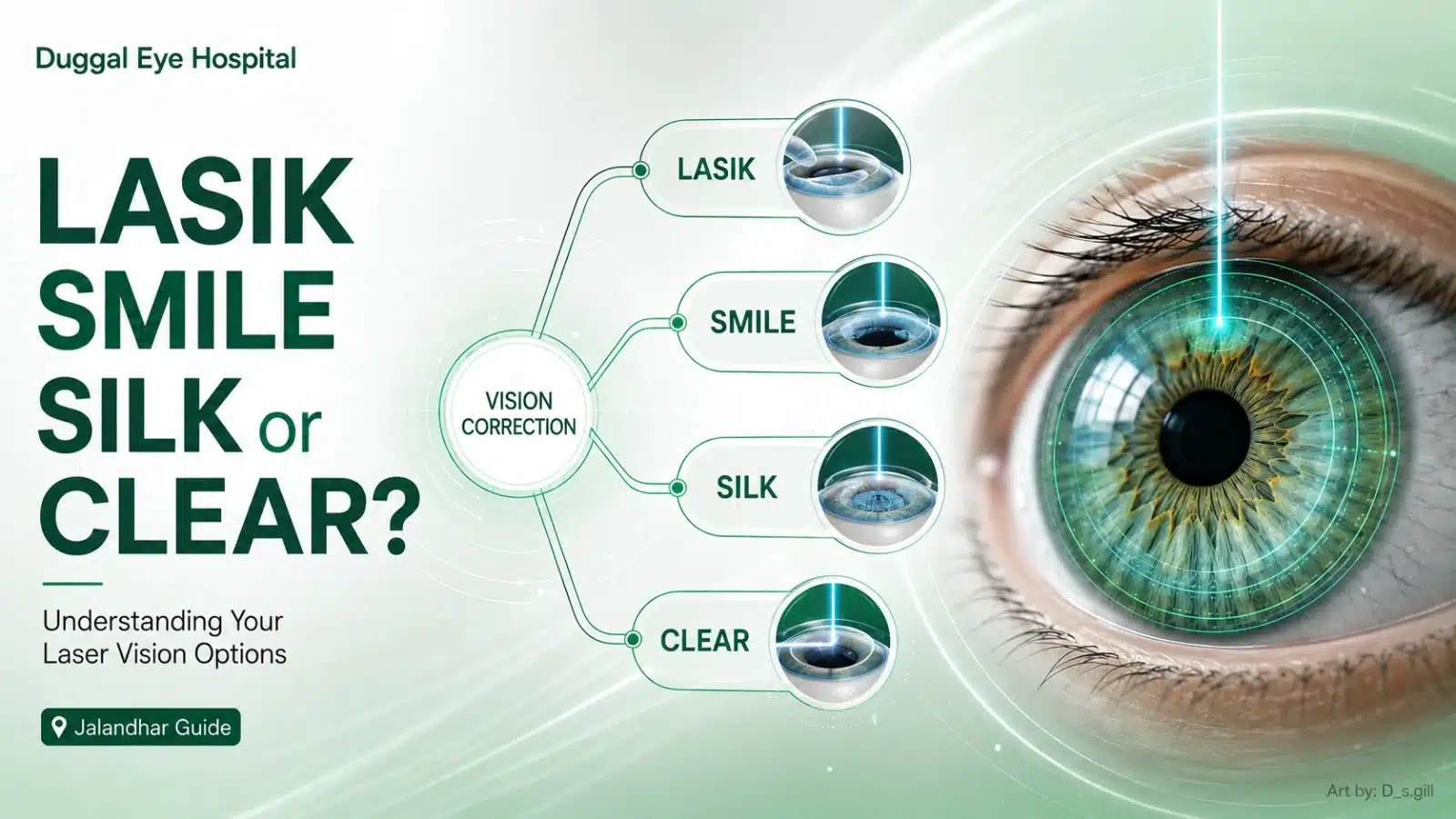 laser vision correction