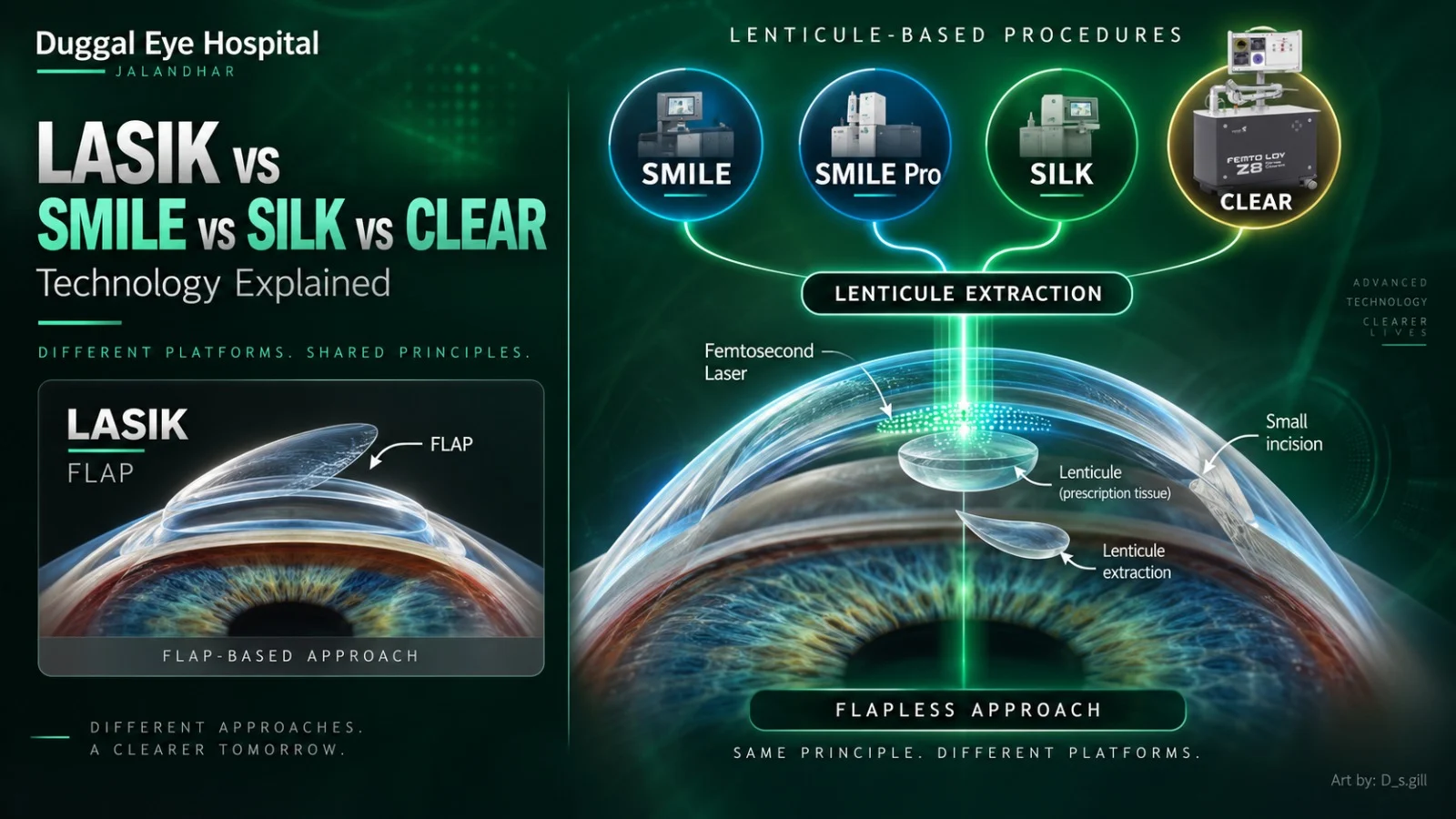 LASIK vs SMILE vs SILK vs CLEAR