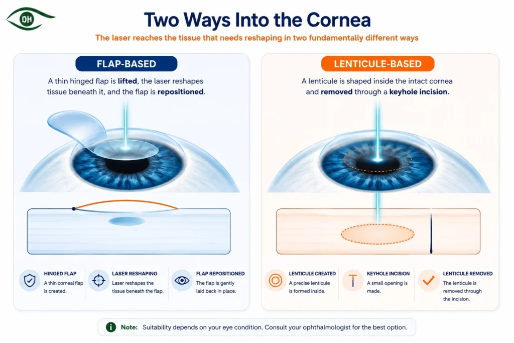 Lenticule-Based Laser Vision Correction